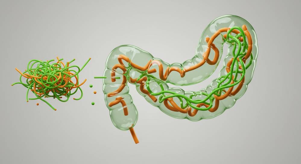 The crucial importance of fiber for digestive health 3 Potential side effects and best practices for increasing fiber